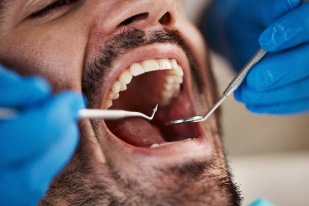 Best Urgent Tooth Repair  in Dysart, IA